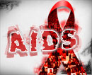 AIDS HIV - �������� ��������� ������������ �����������